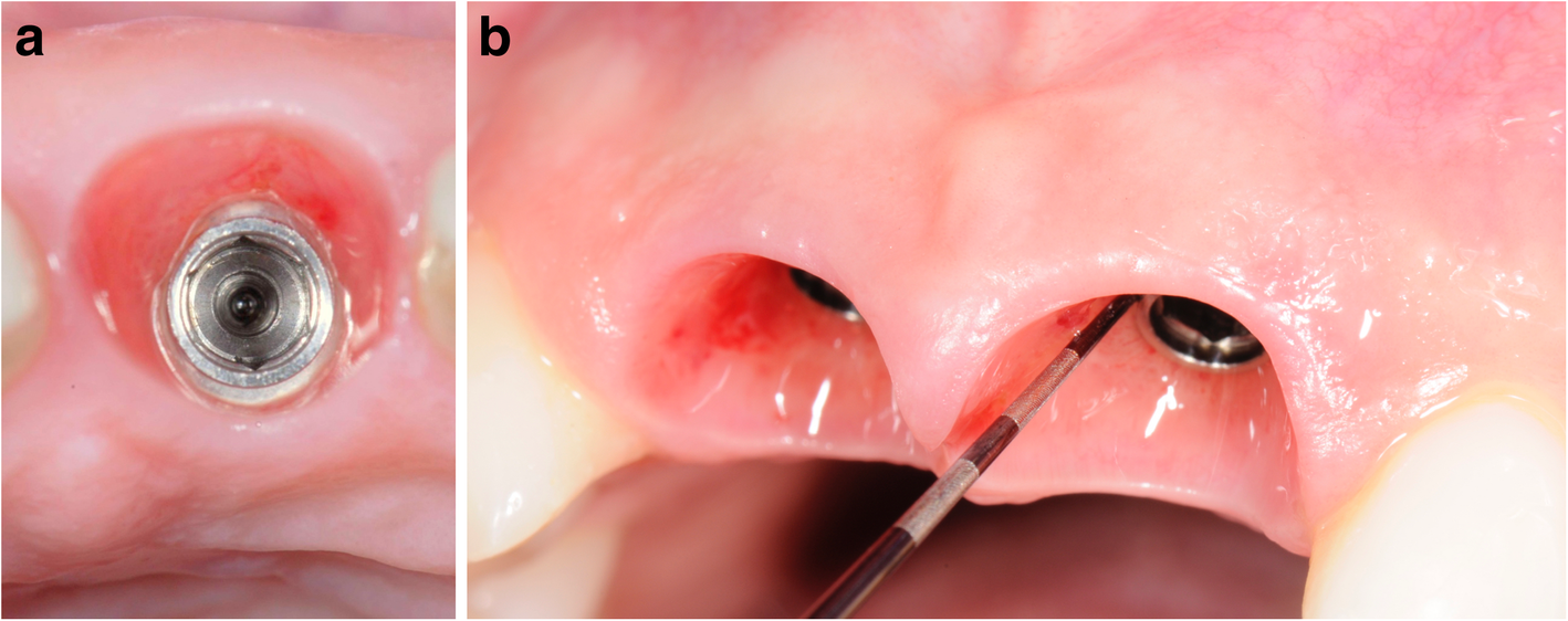 Fig. 7