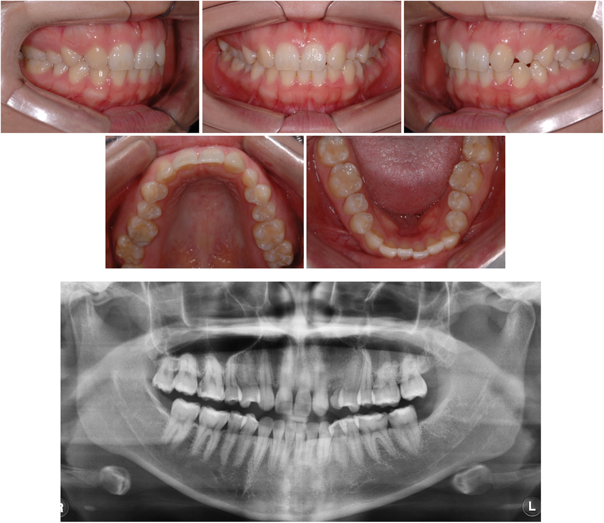 Fig. 1