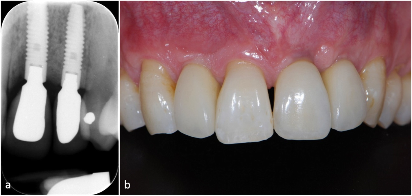 Fig. 4