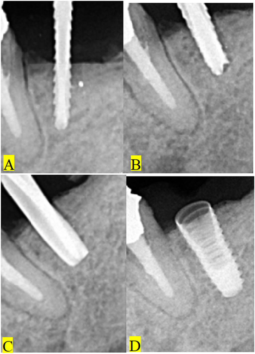 Fig. 5