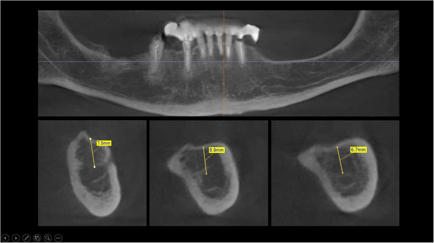 Fig. 10