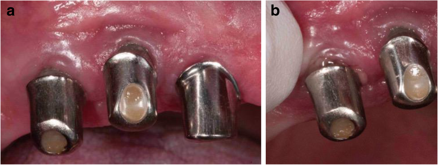 Fig. 8