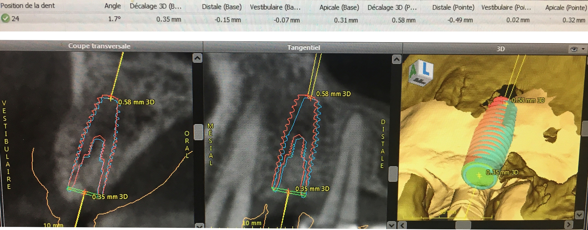 Fig. 3