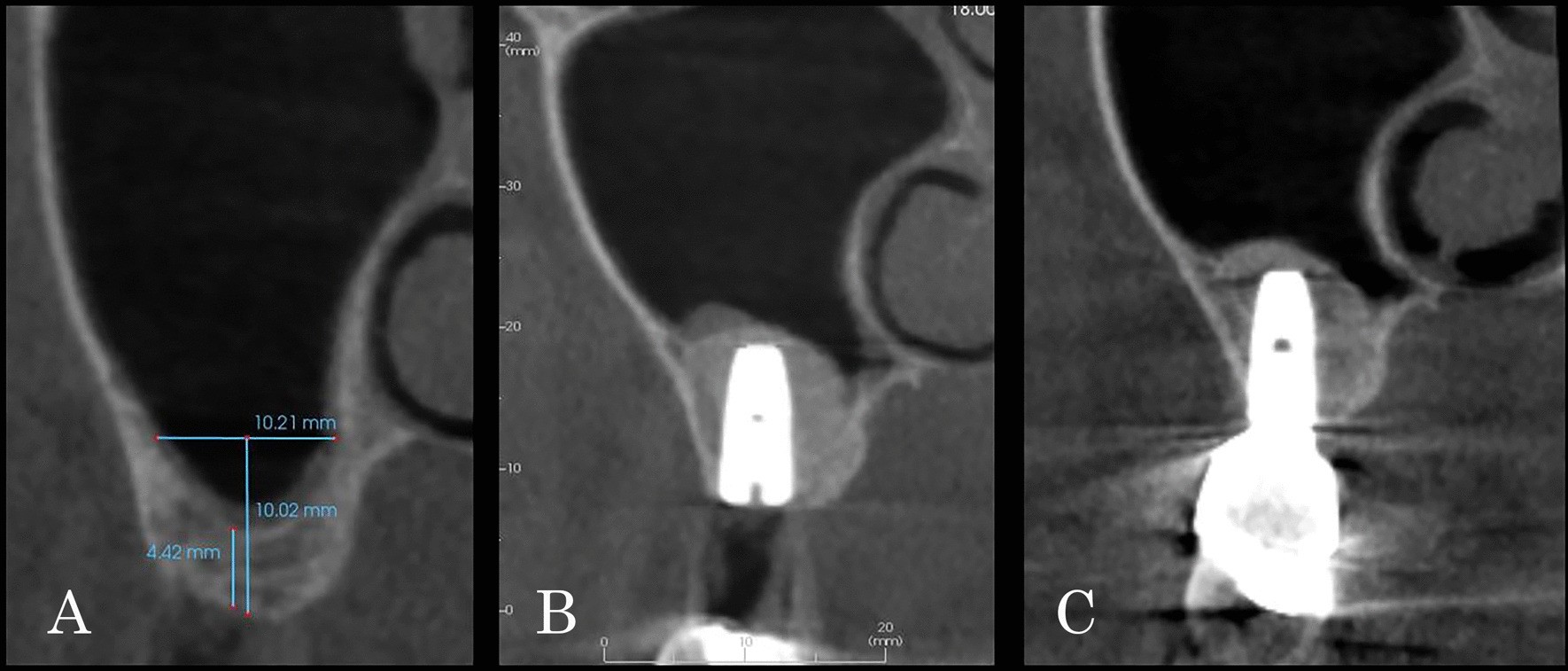 Fig. 5