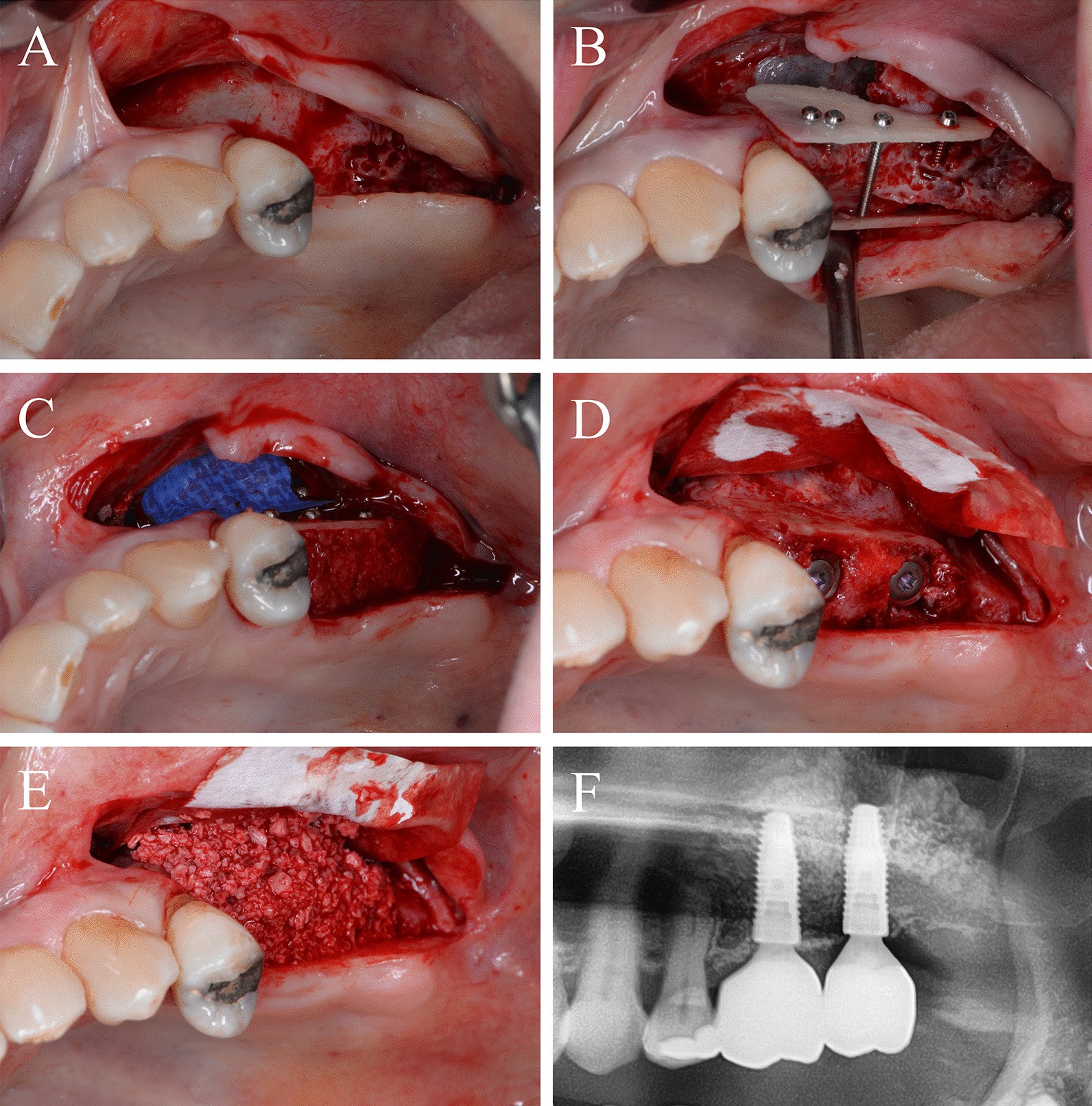 Fig. 3