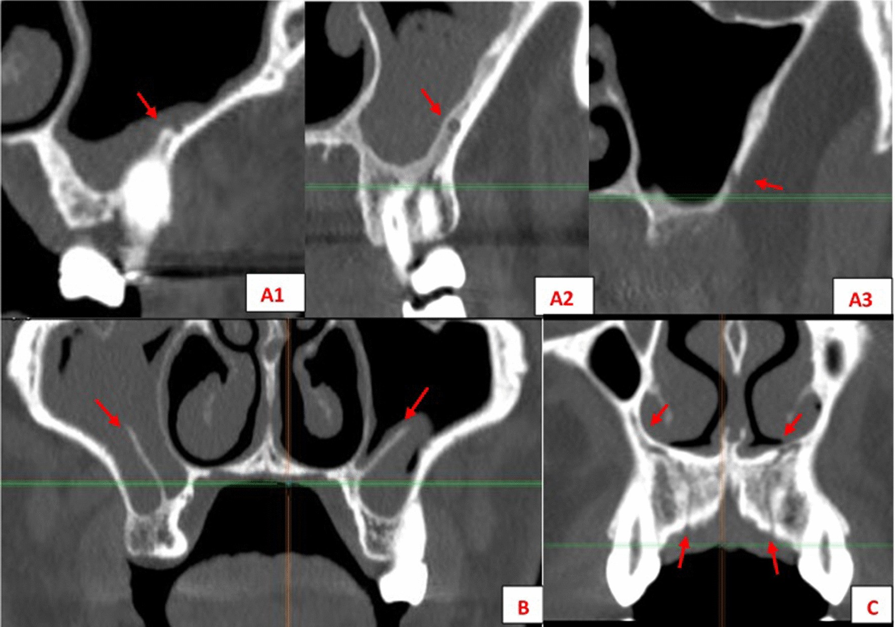 Fig. 1