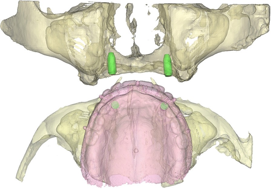 Fig. 1