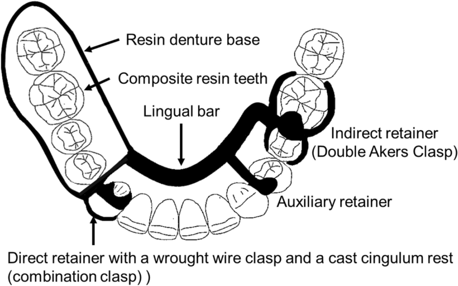 Fig. 1