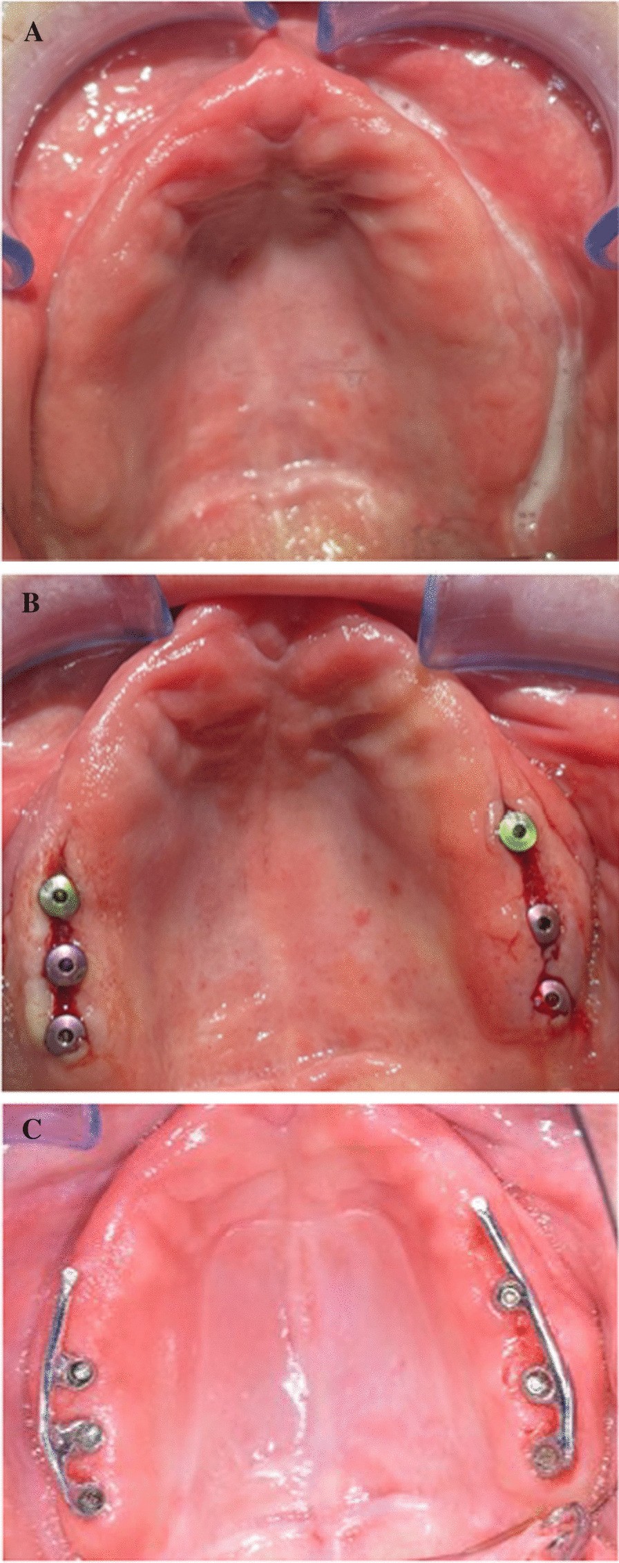 Fig. 4