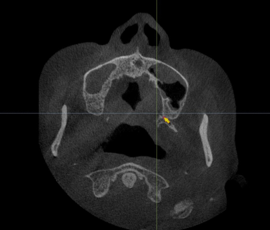 Fig. 2