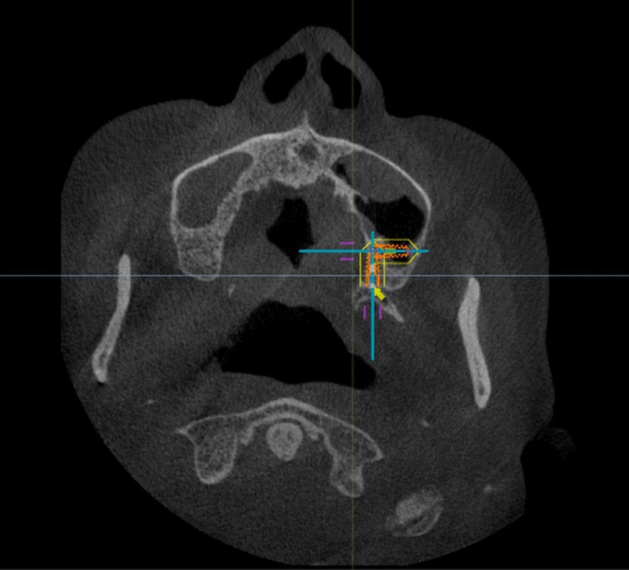 Fig. 4