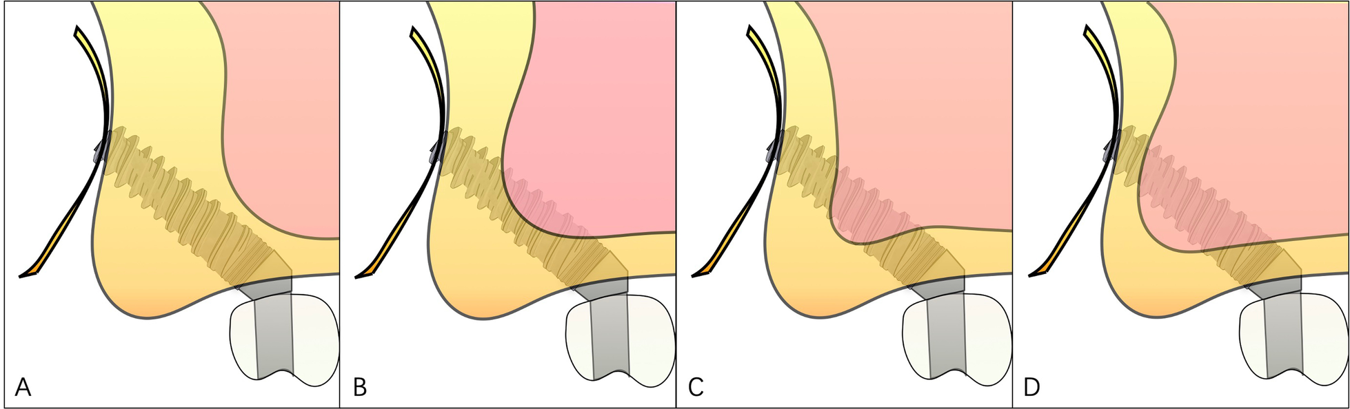 Fig. 9