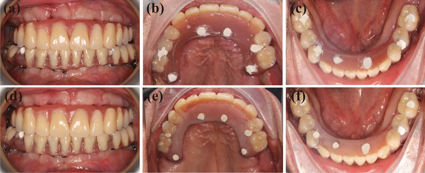 Fig. 11