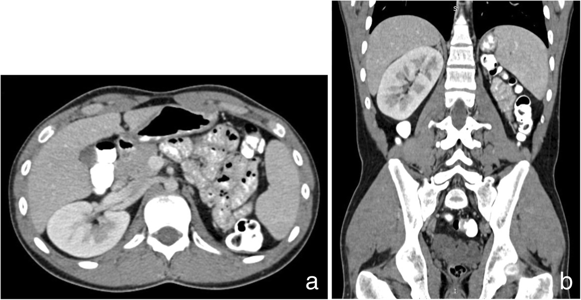 Fig. 1