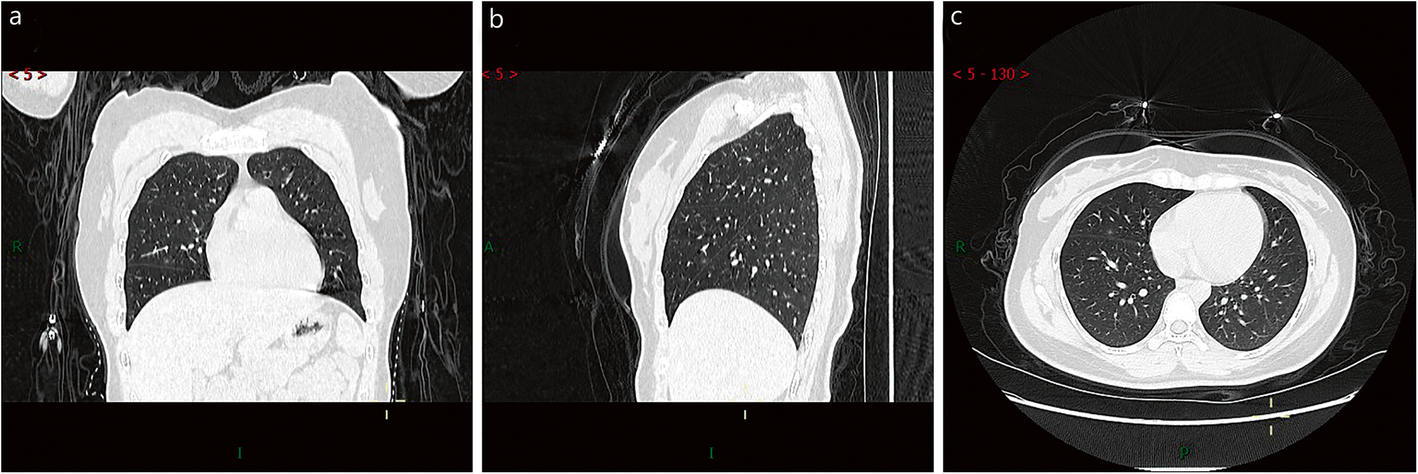 Fig. 5