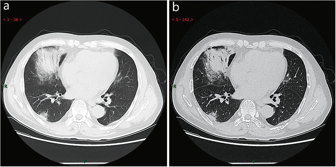 Fig. 9