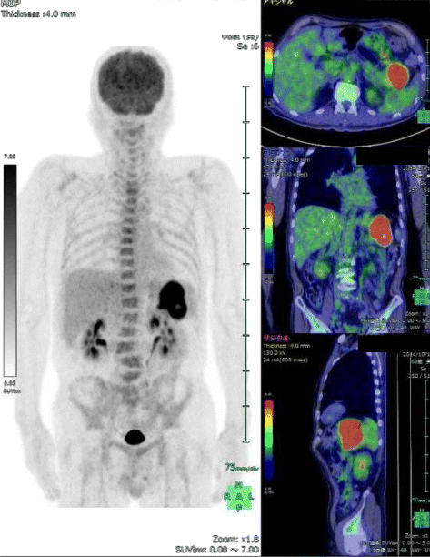 Fig. 2