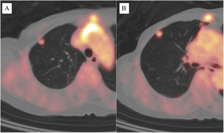 Fig. 5