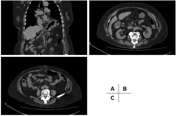 Fig. 1