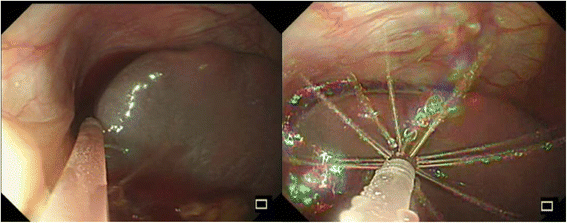 Fig. 4