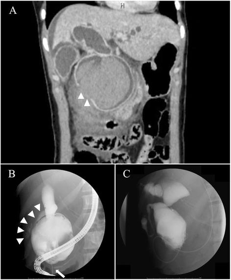 Fig. 1