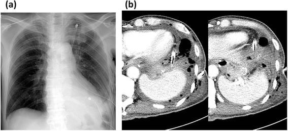 Fig. 4