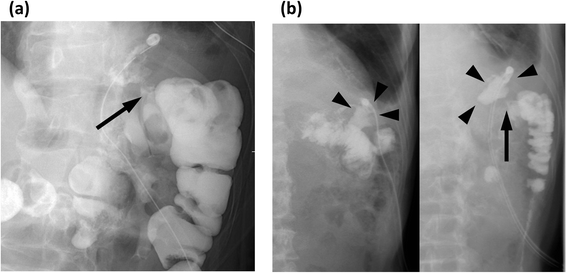 Fig. 5