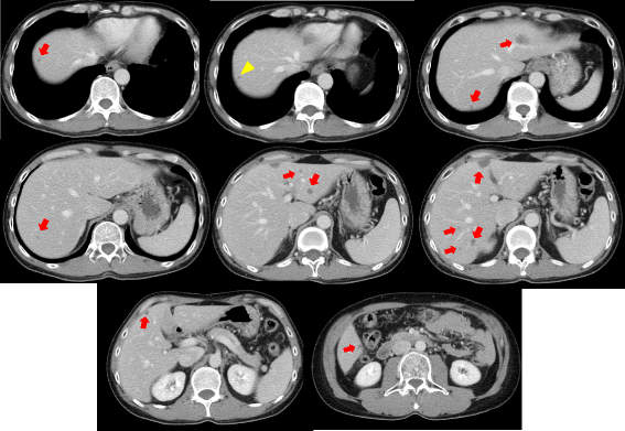 Fig. 3