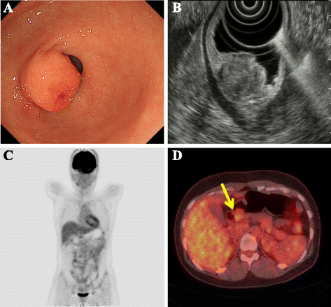 Fig. 1