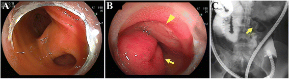 Fig. 2