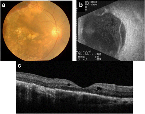 Fig. 4