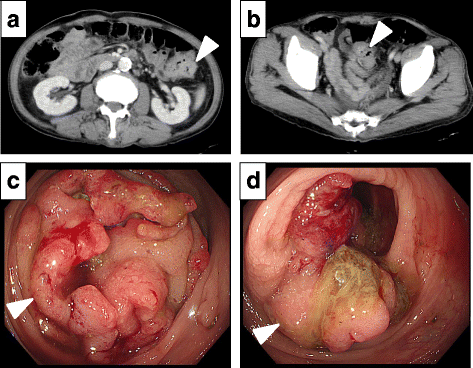 Fig. 2