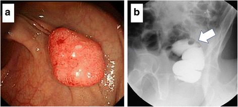 Fig. 1