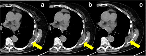 Fig.1