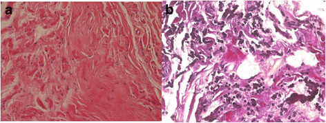 Fig.2