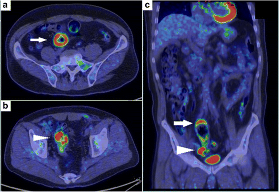 Fig. 3