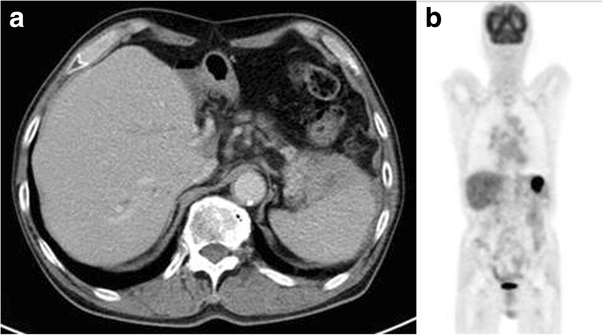 Fig. 5