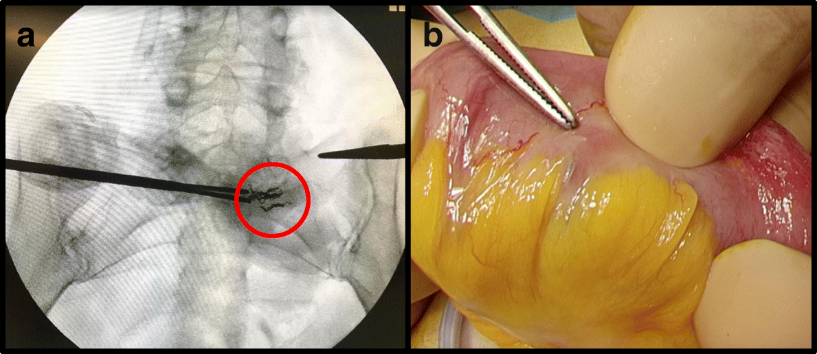 Fig. 3