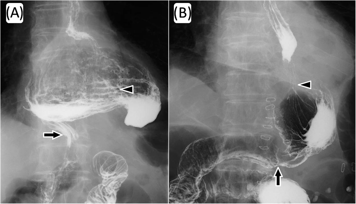 Fig. 1