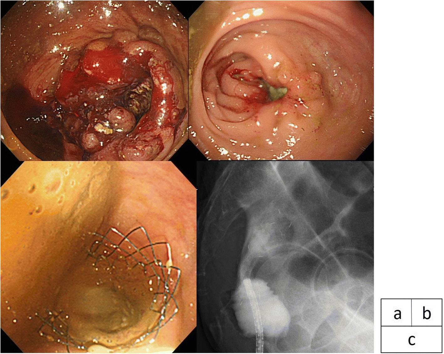 Fig. 1