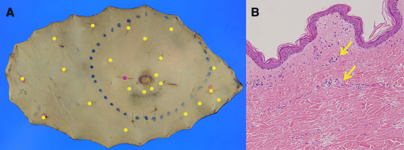 Fig. 4