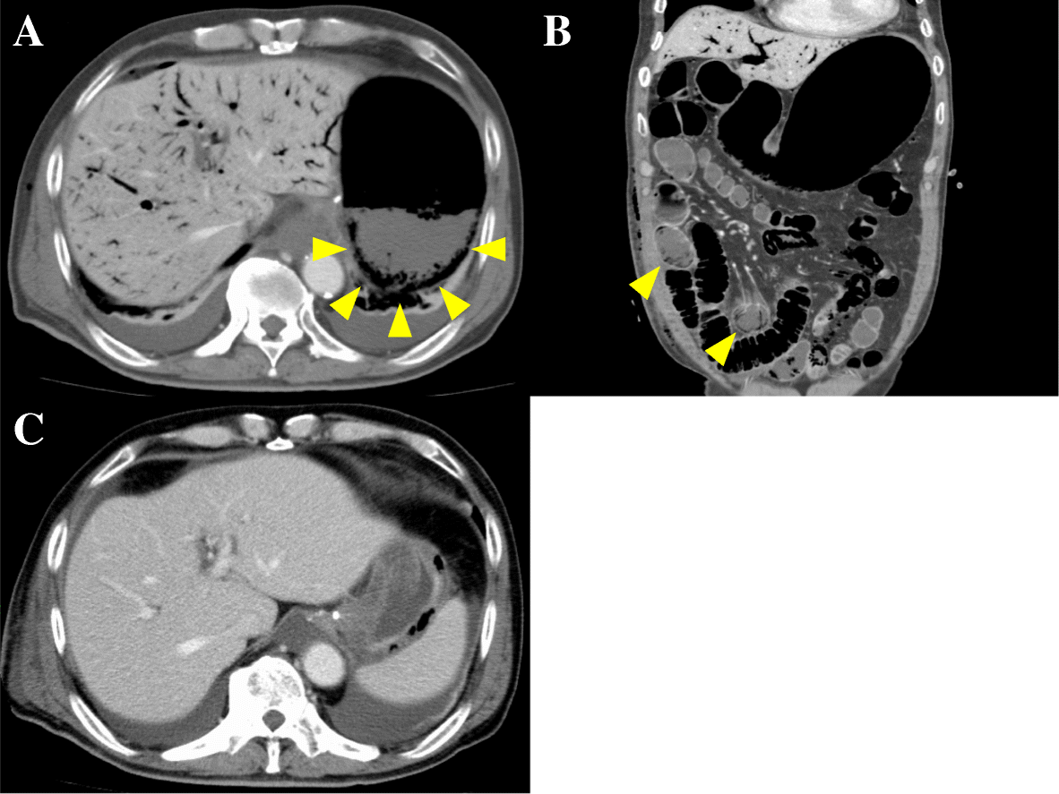 Fig. 1