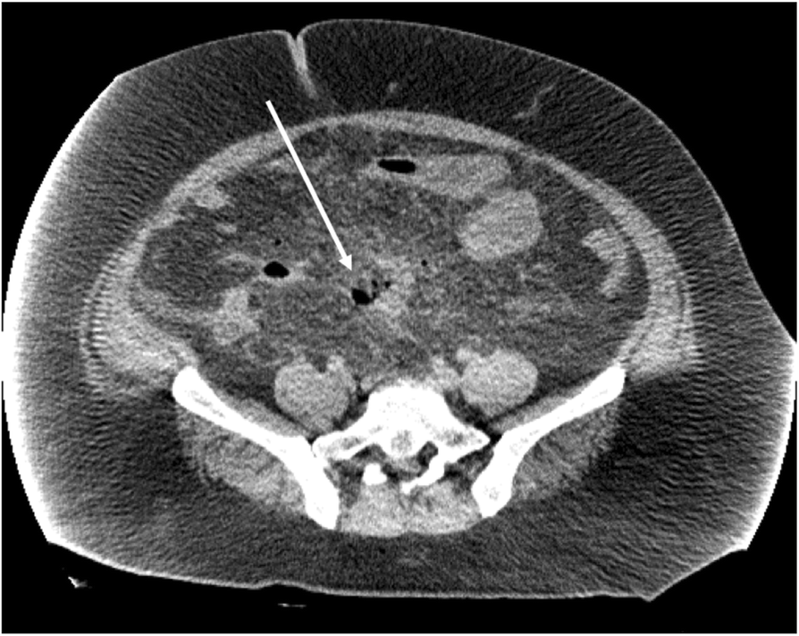 Fig. 2