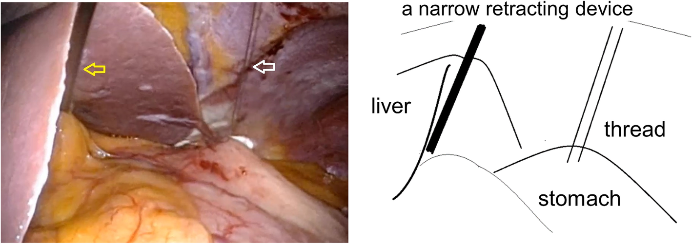 Fig. 1