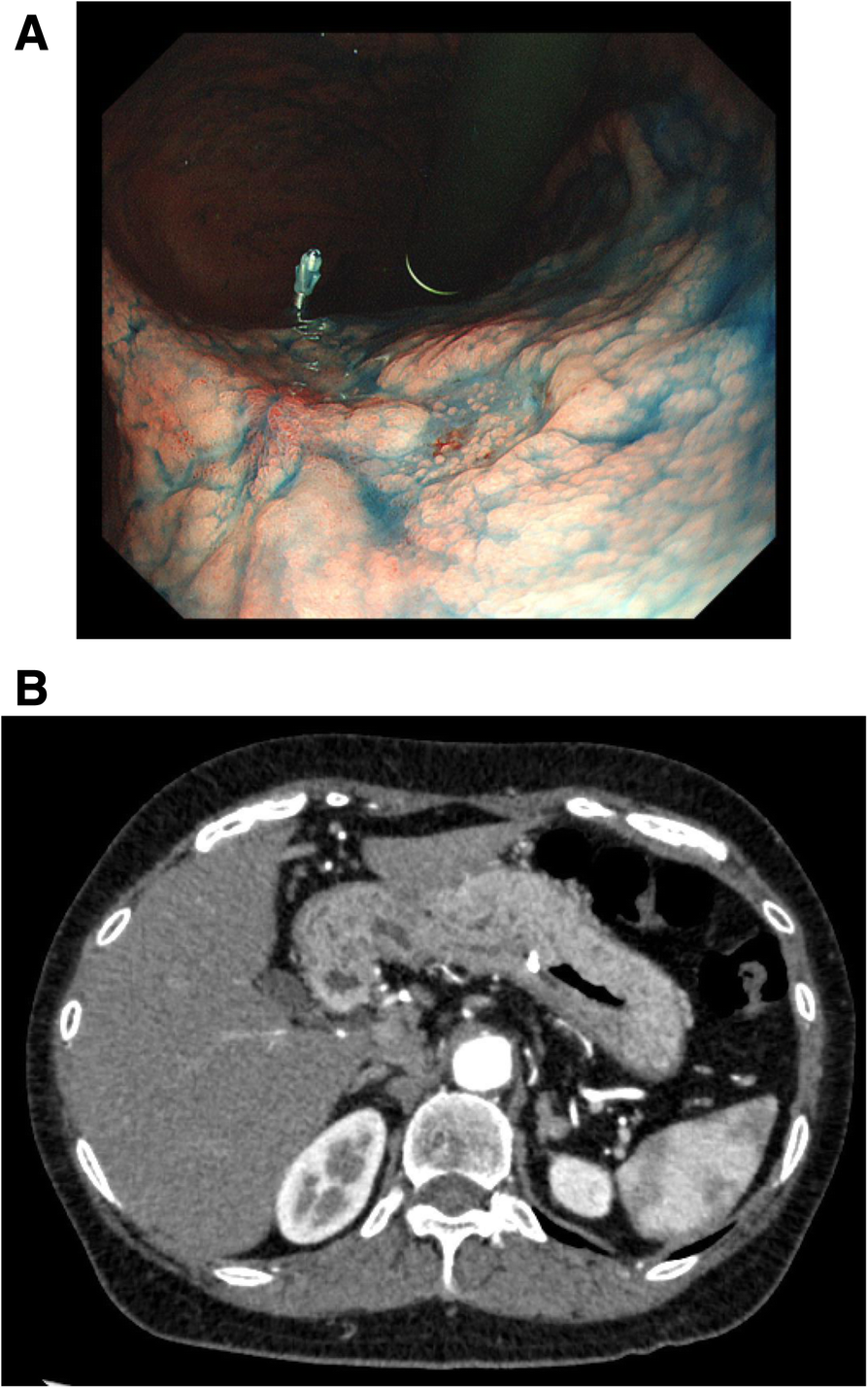 Fig. 1