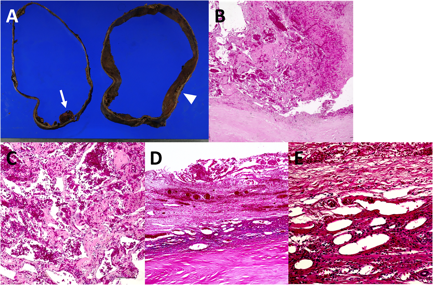 Fig. 4