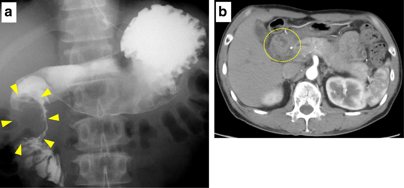 Fig. 2