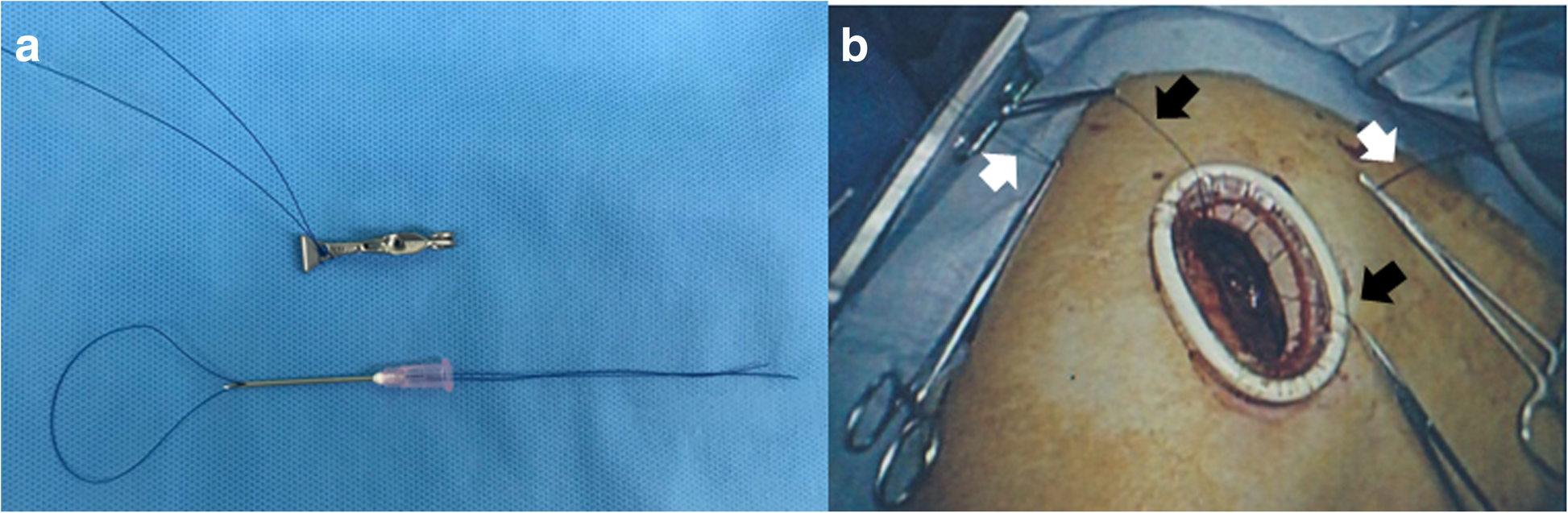 Fig. 2