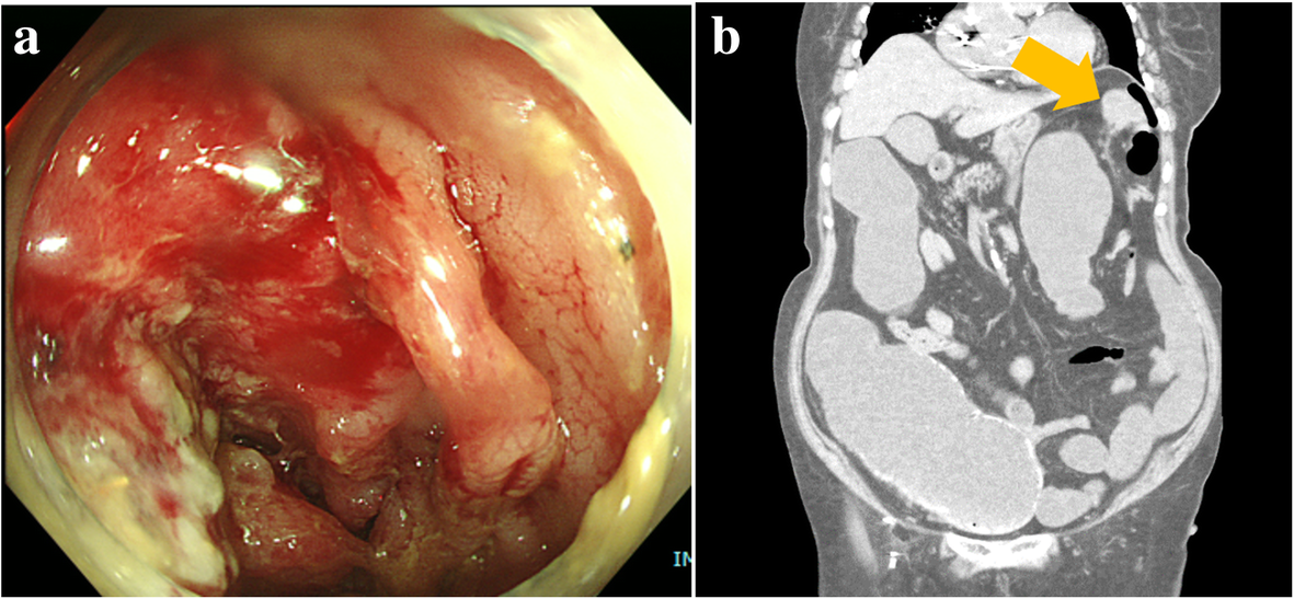 Fig. 1