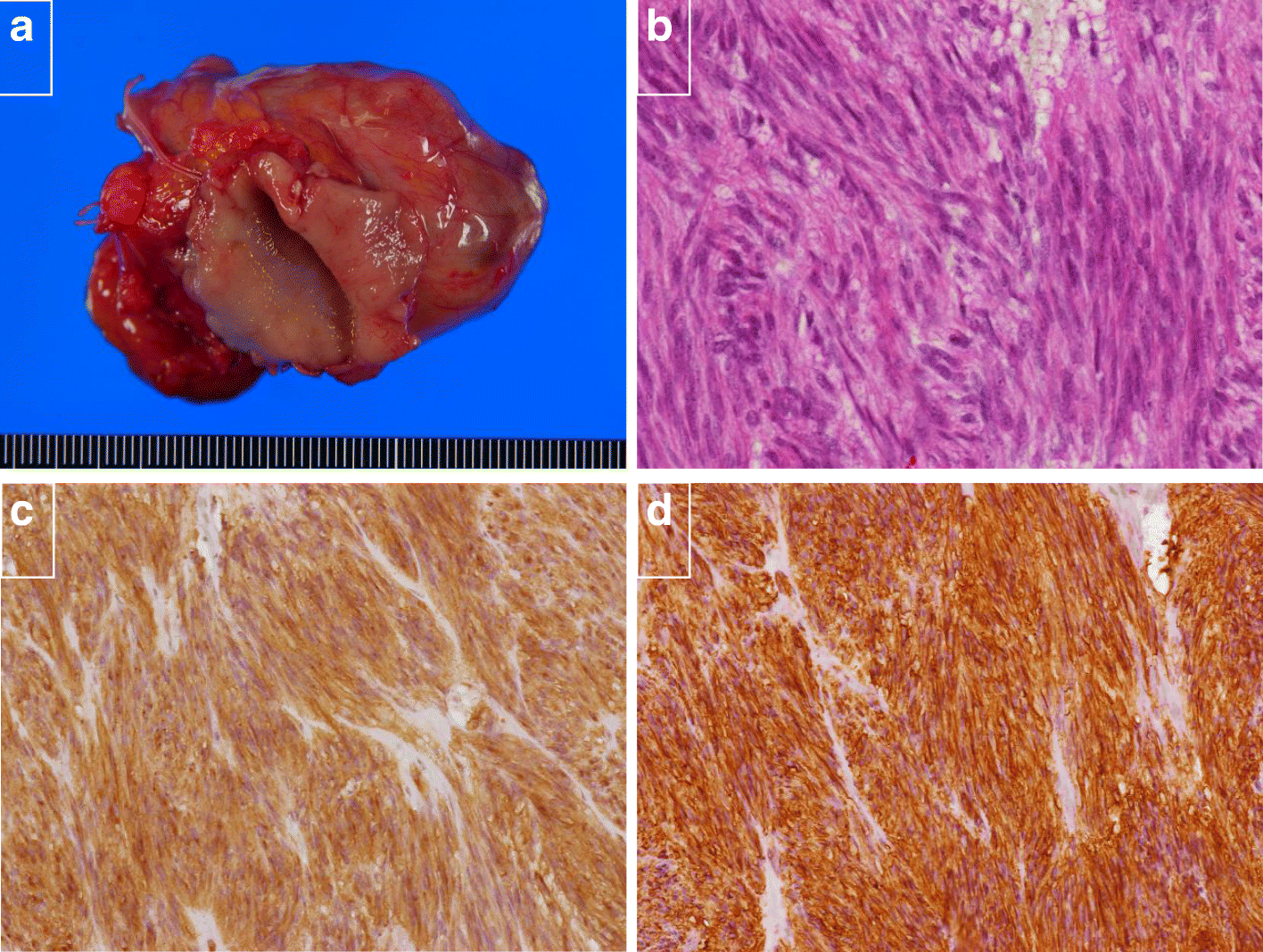 Fig. 4